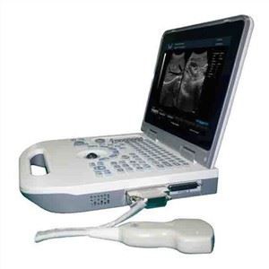 Full Digital Notebook Ultrasound Scanner